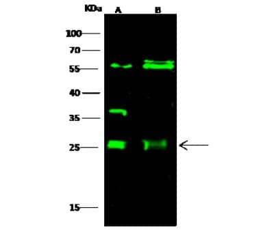 Western Blot: ETHE1 Antibody [NBP3-00355]