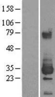 Western Blot: ETHE1 Overexpression Lysate [NBL1-10352]