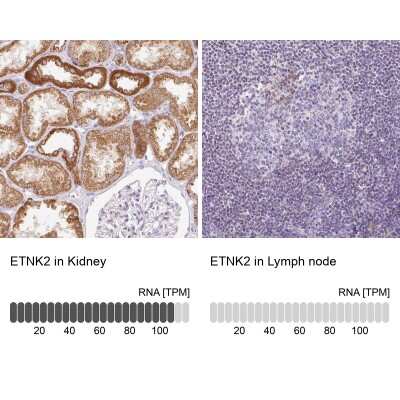 Immunohistochemistry-Paraffin: ETNK2 Antibody [NBP2-49248]