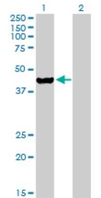 Western Blot: ETNK2 Antibody [H00055224-B01P]