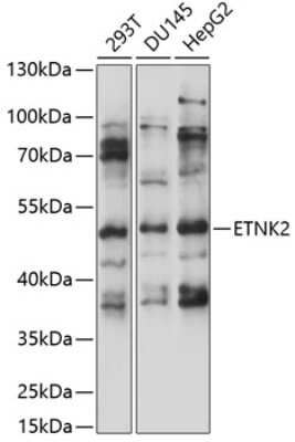 Western Blot: ETNK2 AntibodyAzide and BSA Free [NBP3-04708]