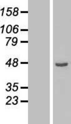 Western Blot: ETNK2 Overexpression Lysate [NBP2-06849]