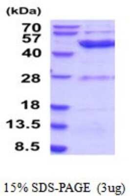 SDS-PAGE: Recombinant Human ETNK2 His Protein [NBP2-52052]