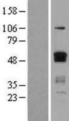 Western Blot: Ets-1 Overexpression Lysate [NBL1-10355]