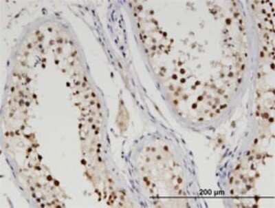 Immunohistochemistry-Paraffin: ETS1 associated protein II Antibody (3D11) [H00051567-M01]