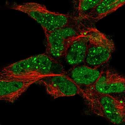 Immunocytochemistry/ Immunofluorescence: ETS1 associated protein II Antibody [NBP2-55948]