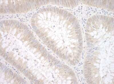 Immunohistochemistry: ETS1 associated protein II Antibody [NBP1-46178]