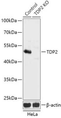 Knockout Validated: ETS1 associated protein II Antibody - Azide and BSA Free [NBP3-03336]