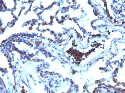 Immunohistochemistry-Paraffin: ETS1 associated protein II Antibody (TDP2/1258) - Azide and BSA Free [NBP2-50071]