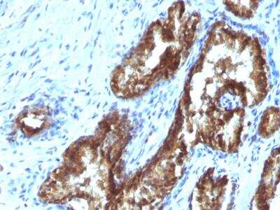 Immunohistochemistry-Paraffin: ETS1 associated protein II Antibody (TDP2/1258) - Azide and BSA Free [NBP2-50071]