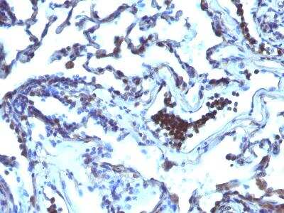 Immunohistochemistry-Paraffin: ETS1 associated protein II Antibody (TDP2/1258) [NBP2-50070]