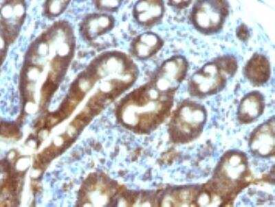 Immunohistochemistry-Paraffin: ETS1 associated protein II Antibody (TDP2/1258) [NBP2-50070]