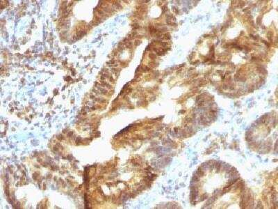 Immunohistochemistry-Paraffin: ETS1 associated protein II Antibody (TDP2/1258) [NBP2-50070]