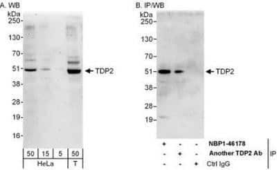 Western Blot: ETS1 associated protein II Antibody [NBP1-46178]