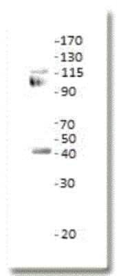 Western Blot: ETS1 associated protein II Antibody [NBP2-11491]