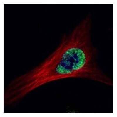 Immunocytochemistry/ Immunofluorescence: ETS2 Antibody [NBP2-14951]