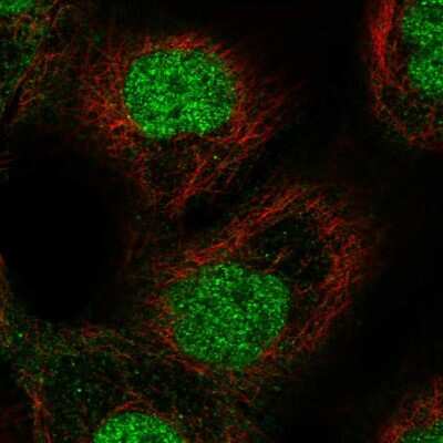 Immunocytochemistry/ Immunofluorescence: ETS2 Antibody [NBP2-58355]