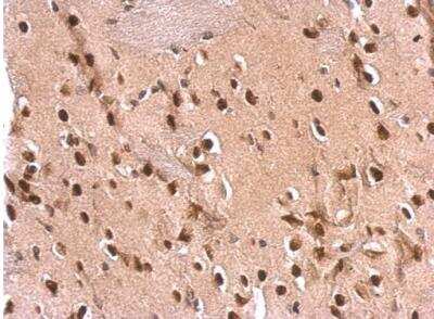 Immunohistochemistry-Paraffin: ETS2 Antibody [NBP2-14951]