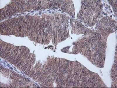 Immunohistochemistry: ETS2 Antibody (OTI2A3) - Azide and BSA Free [NBP2-70694]