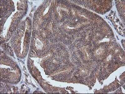 Immunohistochemistry: ETS2 Antibody (OTI2A3) - Azide and BSA Free [NBP2-70694]