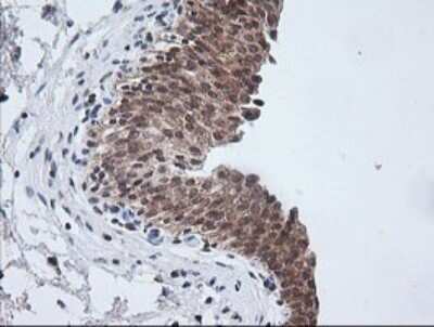 Immunohistochemistry: ETS2 Antibody (OTI2A3) - Azide and BSA Free [NBP2-70694]