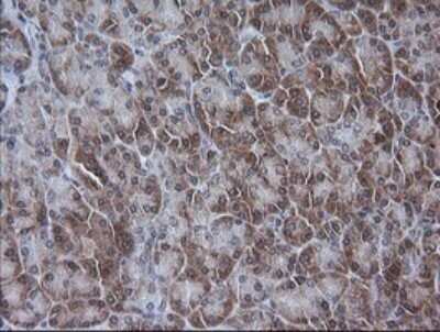 Immunohistochemistry: ETS2 Antibody (OTI2A3) - Azide and BSA Free [NBP2-70694]