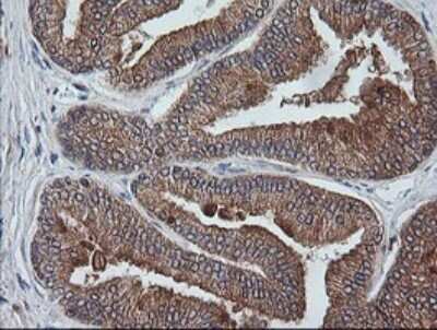 Immunohistochemistry: ETS2 Antibody (OTI2A3) - Azide and BSA Free [NBP2-70694]