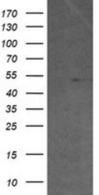 Western Blot: ETS2 Antibody (OTI2A3)Azide and BSA Free [NBP2-70694]