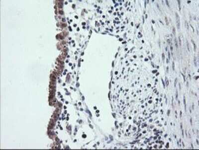 Immunohistochemistry: ETS2 Antibody (OTI2A3) [NBP2-45543]