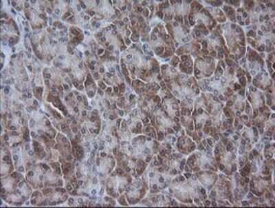 Immunohistochemistry: ETS2 Antibody (OTI2A3) [NBP2-45543]