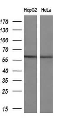 Western Blot: ETS2 Antibody (OTI2A3) [NBP2-45543]
