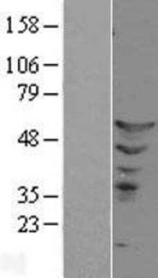 Western Blot: ETS2 Overexpression Lysate [NBL1-10356]