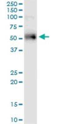 Western Blot: ETV1 Antibody (2A8) [H00002115-M01]