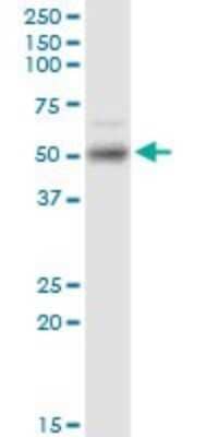 Western Blot: ETV1 Antibody (4C12) [H00002115-M02]