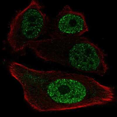 Immunocytochemistry/ Immunofluorescence: ETV1 Antibody [NBP2-57731]