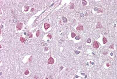 Immunohistochemistry: ETV1 Antibody [NBP3-10480]