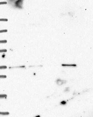 Western Blot: ETV1 Antibody [NBP3-17710]