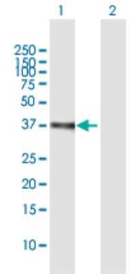 Western Blot: ETV2/ER71 Antibody [H00002116-B01P]