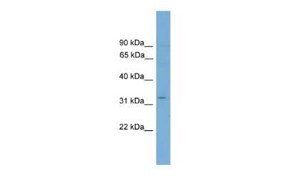 Western Blot: ETV2/ER71 Antibody [NBP3-10400]