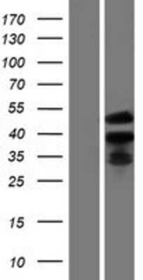 Western Blot: ETV2/ER71 Overexpression Lysate [NBP2-07373]