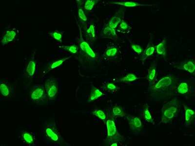 Immunocytochemistry/ Immunofluorescence: ETV3 Antibody [NBP2-98676]