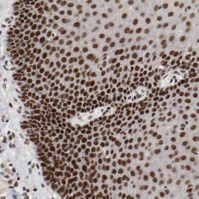 Immunohistochemistry-Paraffin: ETV3 Antibody [NBP1-80931]