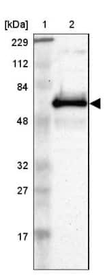 Western Blot: ETV3 Antibody [NBP1-80931]