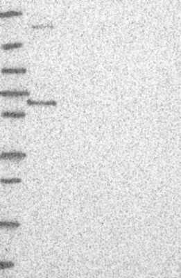 Western Blot: ETV3 Antibody [NBP3-17841]