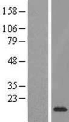 Western Blot: ETV3 Overexpression Lysate [NBL1-10358]