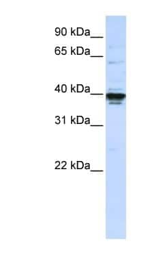 Western Blot: ETV3L Antibody [NBP1-79214]