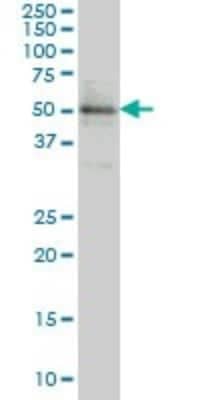 Western Blot: ETV5/ERM Antibody (3B10) [H00002119-M01]