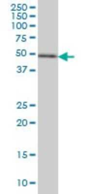 Western Blot: ETV5/ERM Antibody (7C10) [H00002119-M02]