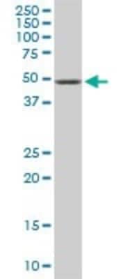 Western Blot: ETV5/ERM Antibody (7C10) [H00002119-M02]