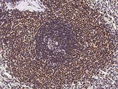 Immunohistochemistry-Paraffin: ETV5/ERM Antibody [NBP2-98876]